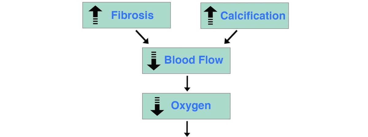 A Hair Loss Flowchart: Why We Lose Our Hair (Hypothesis)