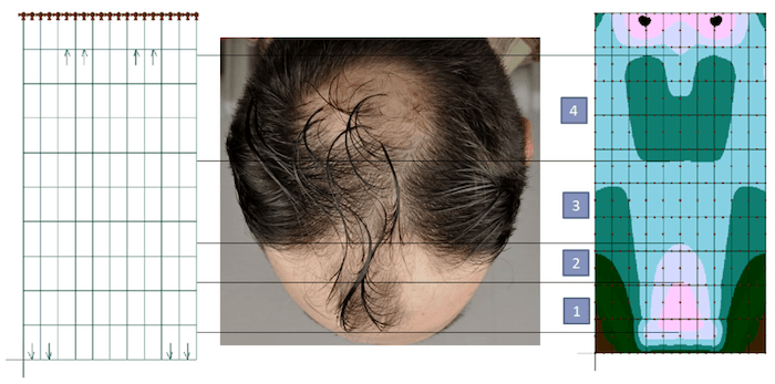 The Scalp Tension Theory Of Hair Loss: A Scientific Breakdown