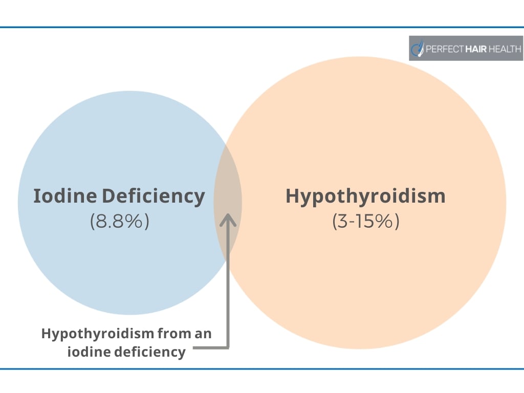 Iodine For Hair Loss? Think Twice About Supplementing