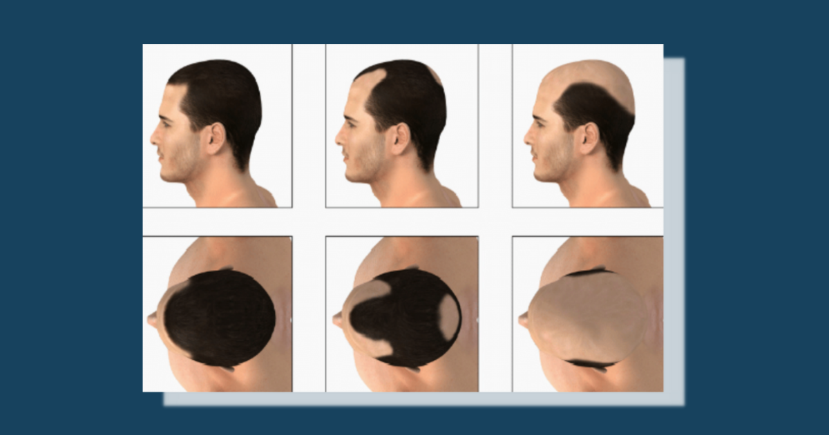 Parts of the Scalp: A Guide to the Anatomy, Mechanics, and New Treatment Possibilities