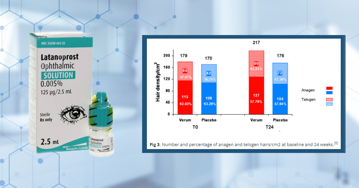 Topical Latanoprost For Hair Loss: Results, Doses, & Side Effect Concerns