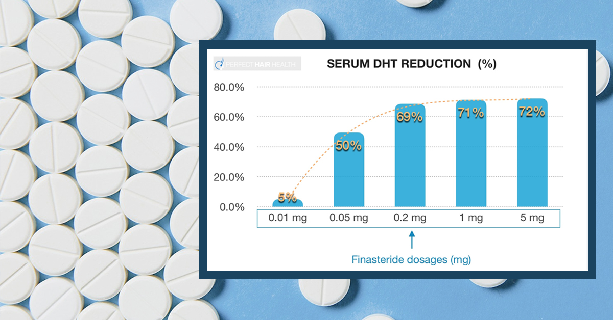 What’s the Best Dose of Finasteride for Hair Loss?