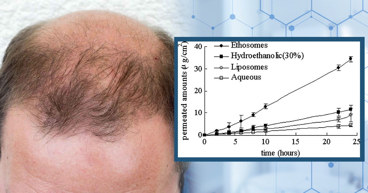 How Long Does Finasteride Stay in Scalp Tissue?