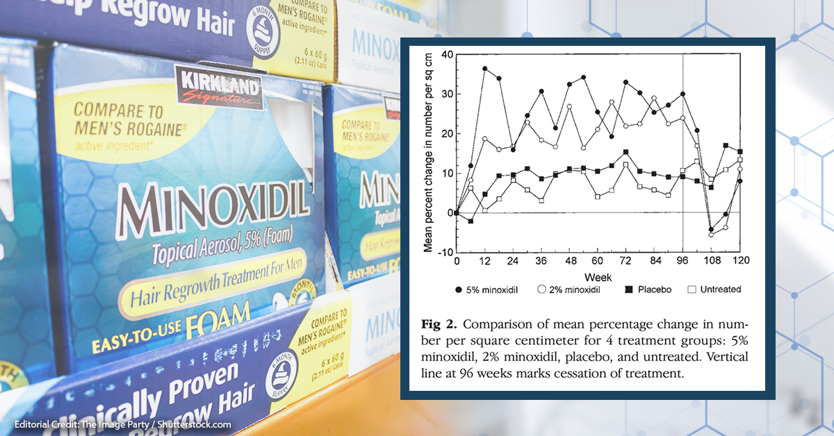 Regrowth from Minoxidil: How Much Should I Expect?