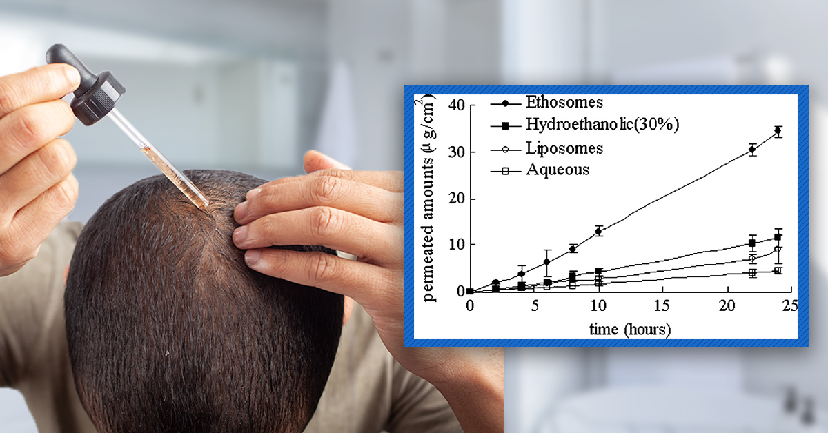 Topical Finasteride: How Can I Minimize My Partner’s Exposure To The Drug?