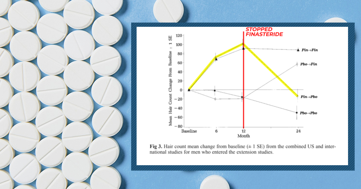 What Is Post-Finasteride Syndrome (PFS)? Is It Real? And What Is Its Prevalence?