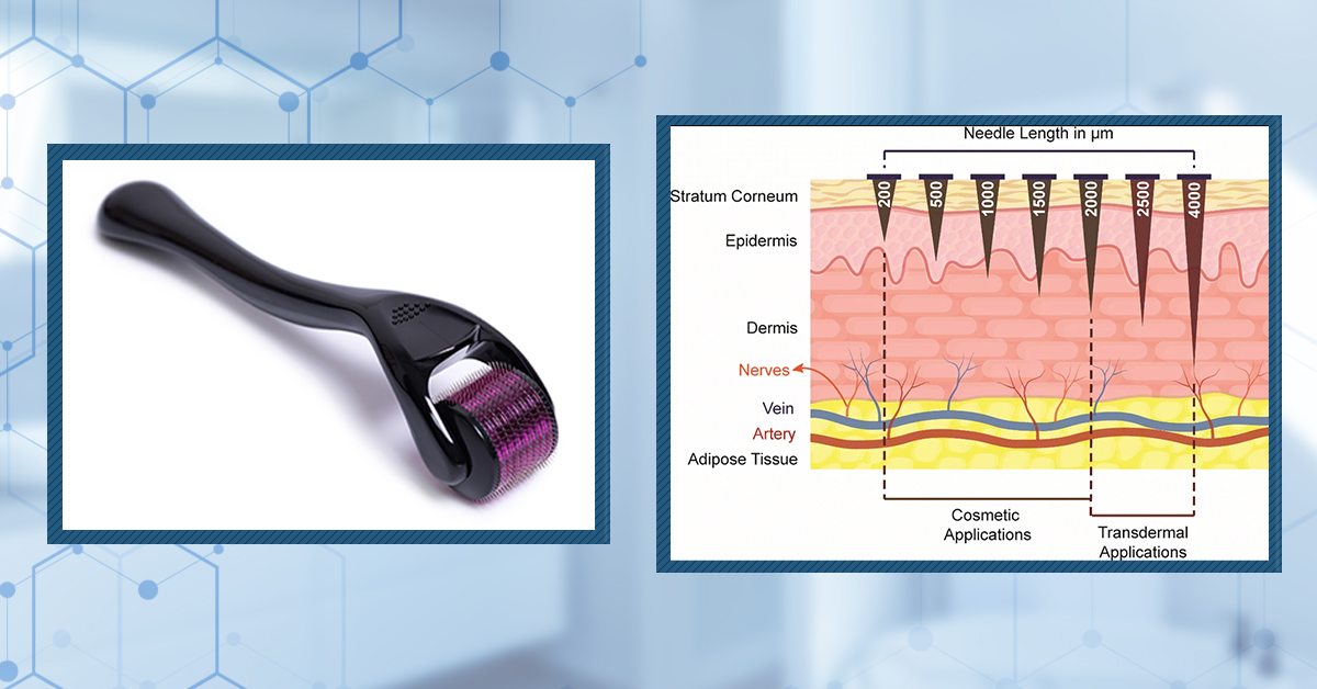 Microneedling the Scalp: Does it Cause Scarring?