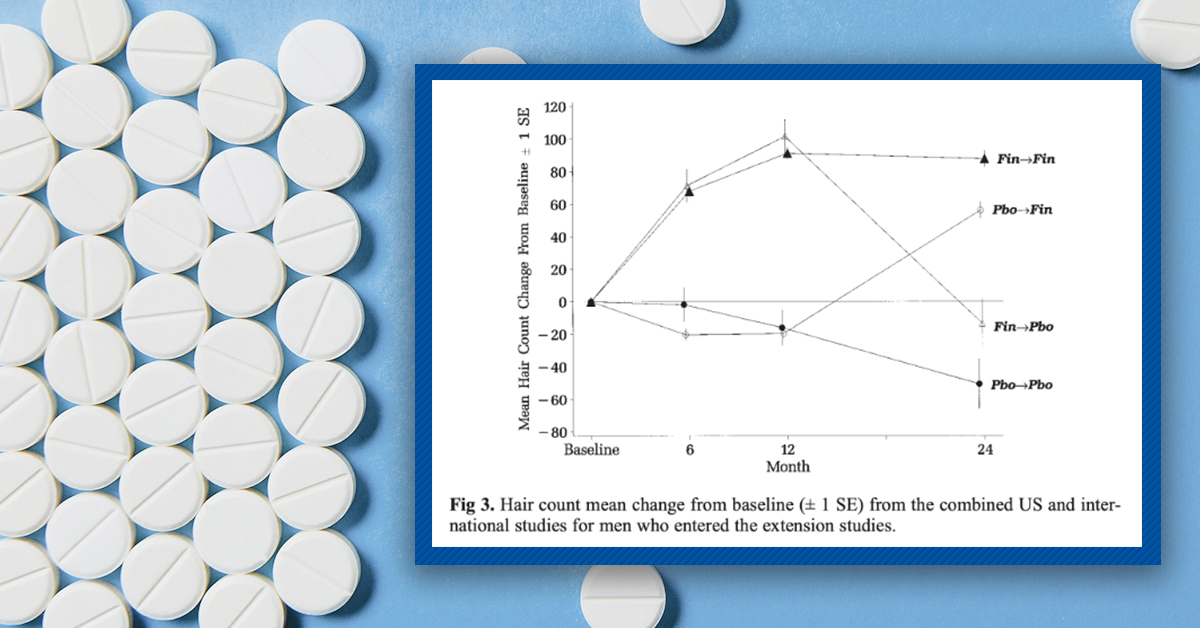 What Happens If I Stop Using Finasteride?